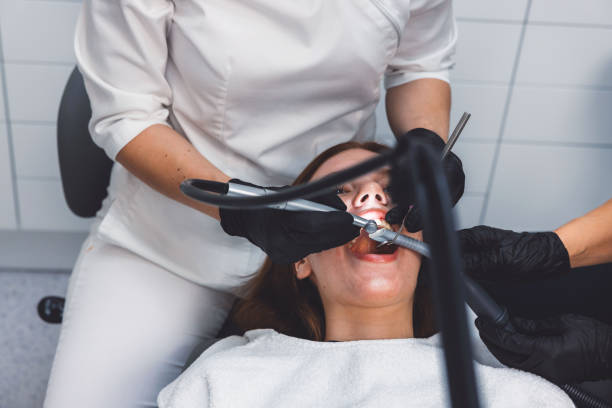 Best Teeth Whitening  in Olivarez, TX